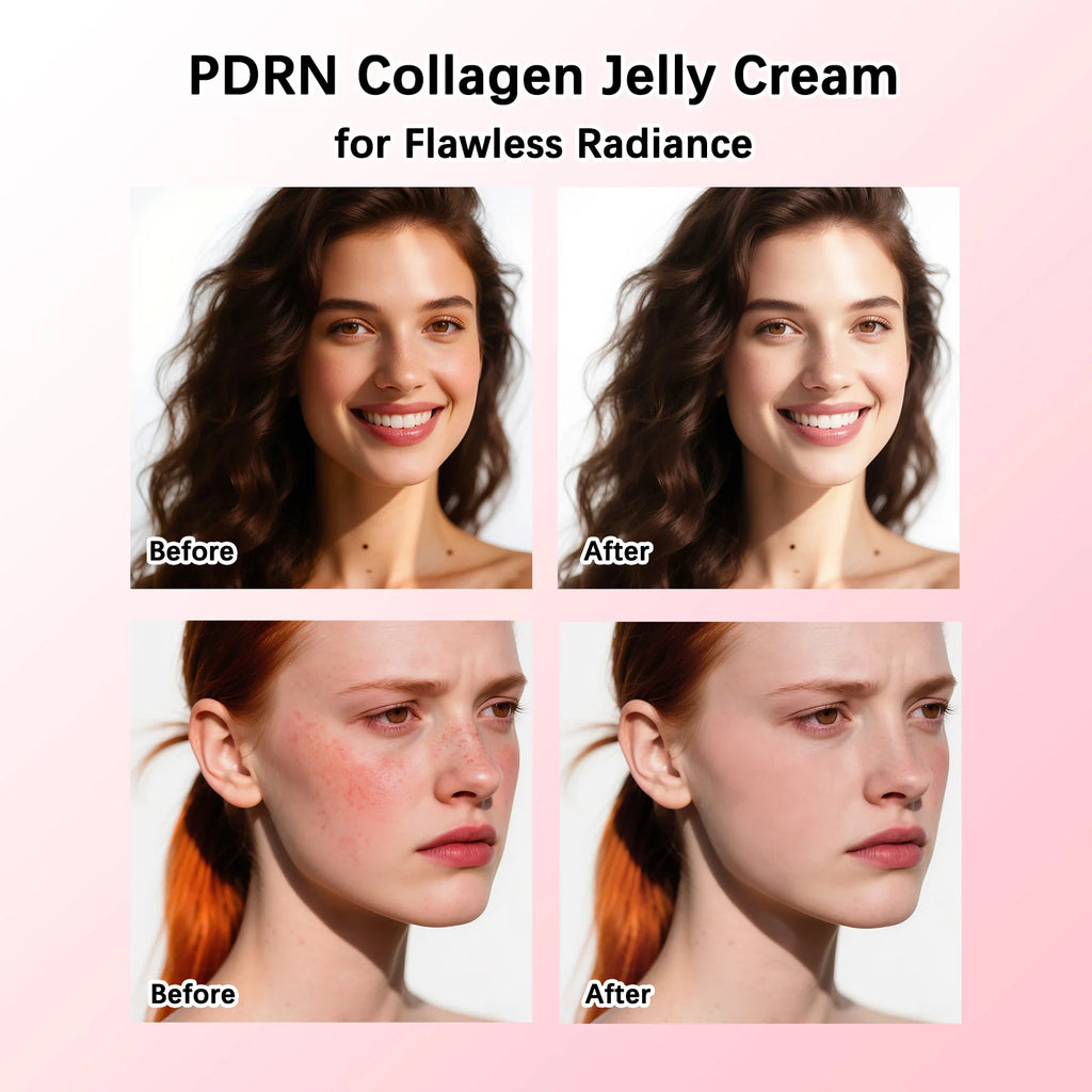Tratamiento Coreano PDRN: Crema de Colágeno Jelly Rejuvenecedora (50ml)