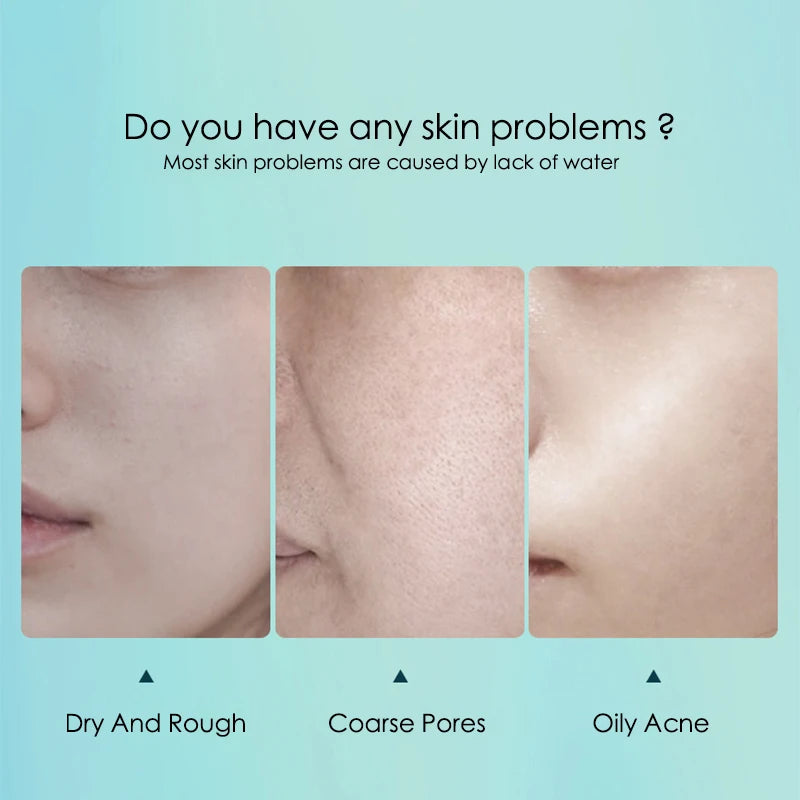 Pack 10 Mascarillas K-Derma: Ácido Hialurónico - Hidratación Profunda