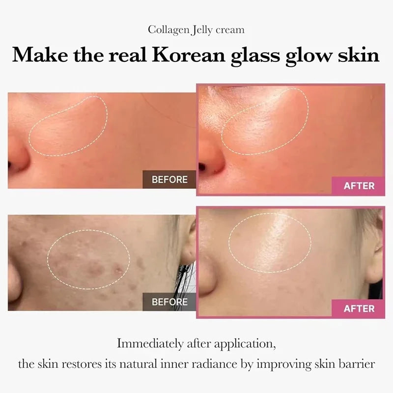 Collagen Jelly Cream K-Derma: Hidratación Viral & Efecto Poros Invisibles